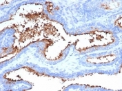 IHC staining of FFPE human prostate tissue with CD13 antibody (clone APN/6998). HIER: boil tissue sections in pH 9 10mM Tris with 1mM EDTA for 20 min and allow to cool before testing.