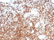 IHC staining of FFPE human tonsil with CD13 antibody (clone APN/6998). HIER: boil tissue sections in pH 9 10mM Tris with 1mM EDTA for 20 min and allow to cool before testing.