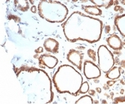 IHC staining of FFPE human thyroid tissue with HSP90AB1 antibody (clone HSP90AB1/4970). HIER: boil tissue sections in pH 9 10mM Tris with 1mM EDTA for 20 min and allow to cool before testing.