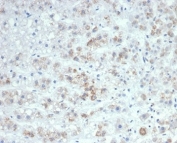 IHC staining of FFPE human adrenal gland tissue with IL-6 antibody (clone IL6/4647) at 2ug/ml. HIER: boil tissue sections in pH 9 10mM Tris with 1mM EDTA for 20 min and allow to cool before testing.