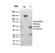 SDS-PAGE analysis of purified, BSA-free Cytokeratin 14 antibody (clone KRT14/4131) as confirmation of integrity and purity.