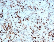 IHC staining of FFPE human spleen tissue with S100A4 antibody (clone S100A4/7096). HIER: boil tissue sections in pH 9 10mM Tris with 1mM EDTA for 20 min and allow to cool before testing.