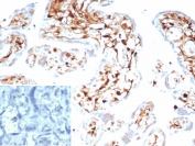 IHC staining of FFPE human placental tissue with S100A4 antibody (clone S100A4/7096). Inset: PBS used in place of primary Ab (secondary Ab negative control). HIER: boil tissue sections in pH 9 10mM Tris with 1mM EDTA for 20 min and allow to cool before testing.