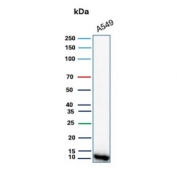 Western blot testing of human A549 cell lysate with S100A4 antibody. Predicted molecular weight ~12 kDa.