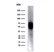Western blot testing of A431 cell lysate with KRT14 antibody (clone KRT14/4128). Predicted molecular weight ~53 kDa.