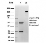 SDS-PAGE analysis of purified, BSA-free KRT14 antibody (clone KRT14/4128) as confirmation of integrity and purity.
