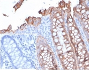 IHC staining of FFPE human colon tissue with recombinant EpCAM antibody (clone rEGP40/7133). Negative control inset: PBS used instead of primary antibody to control for secondary Ab binding.