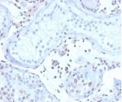 IHC staining of FFPE human testis tissue with MGMT antibody (clone MGMT/4791). HIER: boil tissue sections in pH 9 10mM Tris with 1mM EDTA for 20 min and allow to cool before testing.