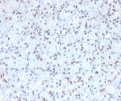 IHC staining of FFPE human stomach tissue with MGMT antibody (clone MGMT/4791). HIER: boil tissue sections in pH 9 10mM Tris with 1mM EDTA for 20 min and allow to cool before testing.