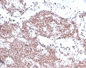 IHC staining of FFPE human lymph node tissue with MGMT antibody (clone MGMT/4791). HIER: boil tissue sections in pH 9 10mM Tris with 1mM EDTA for 20 min and allow to cool before testing.