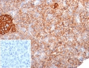 IHC staining of FFPE human pancreas tissue with MIC2 antibody (clone MIC2/7310). Negative control inset: PBS used instead of primary antibody to control for secondary Ab binding. HIER: boil tissue sections in pH 9 10mM Tris with 1mM EDTA for 20 min and allow to cool before testing.