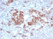 IHC staining of FFPE human pancreas tissue with MIC2 antibody (clone MIC2/7310). HIER: boil tissue sections in pH 9 10mM Tris with 1mM EDTA for 20 min and allow to cool before testing.