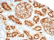 IHC staining of FFPE human kidney tissue with recombinant CD10 antibody (clone MME/6696R). HIER: boil tissue sections in pH 9 10mM Tris with 1mM EDTA for 20 min and allow to cool before testing.