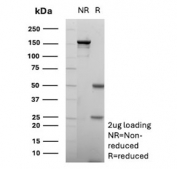 SDS-PAGE analysis of purified, BSA-free recombinant CD10 antibody (clone MME/6696R) as confirmation of integrity and purity.