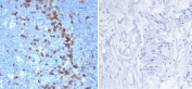 IHC staining of FFPE human tonsil tissue (left) and negative control skin tissue (right) with recombinant PDCD1 antibody (clone PDCD1/7125). HIER: boil tissue sections in pH 9 10mM Tris with 1mM EDTA for 20 min and allow to cool before testing.