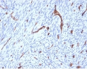 IHC staining of FFPE human uterus tissue with CD31 antibody (clone PECAM1/4341). HIER: boil tissue sections in pH 9 10mM Tris with 1mM EDTA for 20 min and allow to cool before testing.