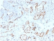 IHC staining of FFPE human cervix tissue with CD31 antibody (clone PECAM1/4341). HIER: boil tissue sections in pH 9 10mM Tris with 1mM EDTA for 20 min and allow to cool before testing.
