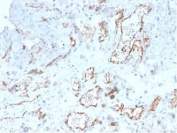 IHC staining of FFPE human cervix tissue with CD31 antibody (clone PECAM1/4341). HIER: boil tissue sections in pH 9 10mM Tris with 1mM EDTA for 20 min and allow to cool before testing.