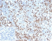 IHC staining of FFPE human tonsil tissue with CD2 antibody (clone LFA2/7104) Negative control inset: PBS used instead of primary antibody to control for secondary Ab binding. HIER: boil tissue sections in pH 9 10mM Tris with 1mM EDTA for 20 min and allow to cool before testing.