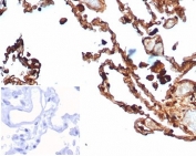 IHC staining of FFPE human lung tissue with S100A4 antibody (clone S100A4/7096). Negative control inset: PBS used instead of primary antibody to control for secondary Ab binding. HIER: boil tissue sections in pH 9 10mM Tris with 1mM EDTA for 20 min and allow to cool before testing.