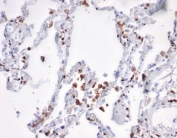 IHC staining of FFPE human lung tissue with S100A4 antibody (clone S100A4/7096). HIER: boil tissue sections in pH 9 10mM Tris with 1mM EDTA for 20 min and allow to cool before testing.