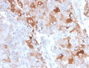 IHC staining of FFPE human adrenal gland with Clusterin antibody (clone CLU/4722). HIER: boil tissue sections in pH 9 10mM Tris with 1mM EDTA for 20 min and allow to cool before testing.