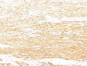 IHC staining of FFPE human colon tissue with recombinant Smoothelin antibody (clone SMTN/2320R). HIER: boil tissue sections in pH6, 10mM citrate buffer, for 20 min and allow to cool before testing.
