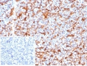 IHC staining of FFPE human kidney tissue with FSCN1 antibody (clone FSCN1/7209). Negative control inset: PBS used instead of primary antibody to control for secondary Ab binding. HIER: boil tissue sections in pH 9 10mM Tris with 1mM EDTA for 20 min and allow to cool before testing.
