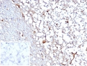 IHC staining of FFPE human cerebellum tissue with recombinant STAT6 antibody (clone STAT6/7163R). Negative control inset: PBS used instead of primary antibody to control for secondary Ab binding. HIER: boil tissue sections in pH 9 10mM Tris with 1mM EDTA for 20 min and allow to cool before testing.