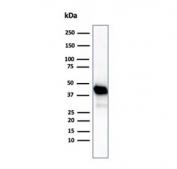 Western blot testing of human Y79 cell lysate using CKB antibody (clone CKBB/6565). Predicted molecular weight ~43 kDa.