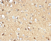IHC staining of FFPE human brain tissue with CKB antibody (clone CKBB/6565). HIER: boil tissue sections in pH 9 10mM Tris with 1mM EDTA for 20 min and allow to cool before testing.