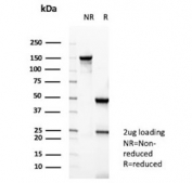 SDS-PAGE analysis of purified, BSA-free CKB antibody (clone CKBB/6565) as confirmation of integrity and purity.