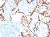 IHC staining of FFPE human placental tissue with PVRL4 antibody (clone NECT4/7271). Negative control inset: PBS used instead of primary antibody to control for secondary Ab binding. HIER: boil tissue sections in pH 9 10mM Tris with 1mM EDTA for 20 min and allow to cool before testing.