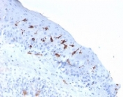 IHC staining of FFPE human skin tissue with CD1a antibody (clone C1A/2777). HIER: boil tissue sections in pH 9 10mM Tris with 1mM EDTA for 20 min and allow to cool before testing.