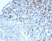 IHC staining of FFPE human tonsil tissue with LFA-2 antibody (clone LFA2/7100). Negative control inset: PBS used instead of primary antibody to control for secondary Ab binding. HIER: boil tissue sections in pH 9 10mM Tris with 1mM EDTA for 20 min and allow to cool before testing.