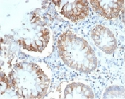 IHC staining of FFPE human colon tissue with LFA-2 antibody (clone LFA2/7100). HIER: boil tissue sections in pH 9 10mM Tris with 1mM EDTA for 20 min and allow to cool before testing.