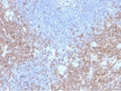 IHC staining of FFPE human lymph node tissue with CD2 antibody (clone LFA2/7106). HIER: boil tissue sections in pH 9 10mM Tris with 1mM EDTA for 20 min and allow to cool before testing.