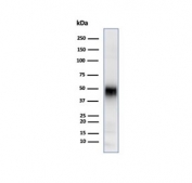 Western blot testing of Jurkat cell lysate using CD2 antibody (clone LFA2/7106). Expected molecular weight ~47 kDa.