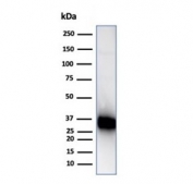 Western blot testing of Raji cell lysate with CD74 antibody (clone CLIP/7193). Expected molecular weight: 33-43 kDa.