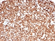 IHC staining of FFPE human spleen tissue with CD74 antibody (clone CLIP/7193) at 2ug/ml. HIER: boil tissue sections in pH 9 10mM Tris with 1mM EDTA for 20 min and allow to cool before testing.