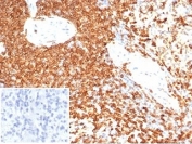 IHC staining of FFPE human spleen tissue with CD74 antibody (clone CLIP/7193) at 2ug/ml. Negative control inset: PBS used instead of primary antibody to control for secondary Ab binding. HIER: boil tissue sections in pH 9 10mM Tris with 1mM EDTA for 20 min and allow to cool before testing.