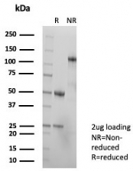 SDS-PAGE analysis of purified, BSA-free TAG-72 antibody (clone TAG72/8317R) as confirmation of integrity and purity.