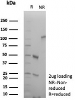 SDS-PAGE analysis of purified, BSA-free CD29 antibody (clone ITGB1/8744R) as confirmation of integrity and purity.
