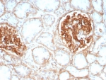 IHC staining of FFPE human kidney tissue with CD29 antibody (clone ITGB1/8744R). HIER: boil tissue sections in pH 9 10mM Tris with 1mM EDTA for 20 min and allow to cool before testing.