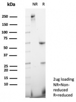 SDS-PAGE analysis of purified, BSA-free NRP1 / Neuropilin-1 antibody (clone NRP1/4620) as confirmation of integrity and purity.