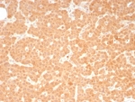 IHC staining of FFPE human parathyroid tissue with c-RET antibody (clone RET/8787). HIER: boil tissue sections in pH 9 10mM Tris with 1mM EDTA for 20 min and allow to cool before testing.