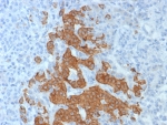 IHC staining of FFPE human pancreas tissue with GAD2 antibody (clone GAD2/8394R). HIER: boil tissue sections in pH 9 10mM Tris with 1mM EDTA for 20 min and allow to cool before testing.