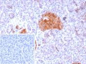 Immunohistochemistry of GAD2 Antibody Recombinant Rabbit MAb GAD2/8547R in human pancreas. Formalin-fixed, paraffin-embedded human pancreatic tissue demonstrates strong HRP-DAB brown cytoplasmic staining in islet cells, consistent with Glutamate decarboxylase 2 / GAD65 expression in pancreatic neuroendocrine cells. Surrounding exocrine acinar tissue shows minimal staining. Heat-induced epitope retrieval was performed by boiling tissue sections in pH 9 10mM Tris with 1mM EDTA for 20 min followed by cooling prior to antibody incubation.