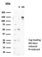 SDS-PAGE analysis of purified, BSA-free SFMBT2 antibody (clone PCRP-SFMBT2-1B7) as confirmation of integrity and purity.