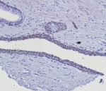 IHC staining of FFPE human prostate tissue with GATA-3 antibody (clone GATA3/8327R). HIER: boil tissue sections in pH 9 10mM Tris with 1mM EDTA for 20 min and allow to cool before testing.